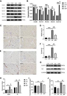 Pinocembrin ameliorates atrial fibrillation susceptibility in rats with anxiety disorder induced by empty bottle stimulation